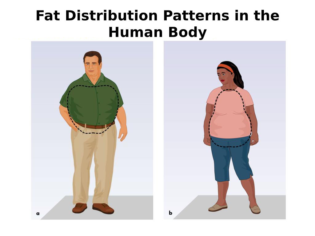 Fat distribution patterns in the human body